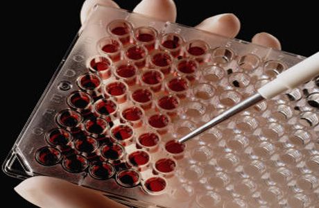 Transmiterea heterosexuală a HIV: noi descoperiri