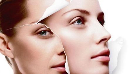 - proceduri de rejuvenare non-chirurgicale