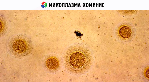 Infectiile cu Mycoplasme