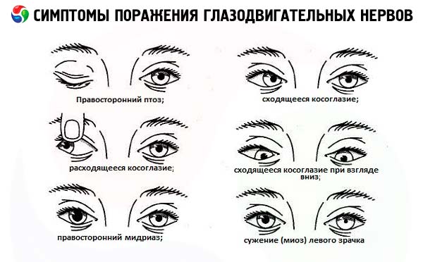funcția oculomotorie a vederii