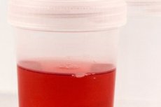 creșterea globulelor roșii în urină cu prostatita