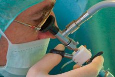 intervenție chirurgicală pentru îndepărtarea prostatitei cum se trateaza prostatita cu acupunctura