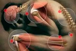 caracteristicile sindromului de durere în prostatită