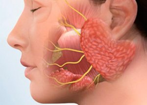 motiv de tratare a artrozei vertebrale cervicale