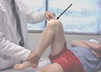 Dureri de genunchi în timpul flexiei și alungirii unguentului, Dureri de genunchi în timpul flexiei
