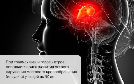 Riscul de accident vascular cerebral crește în primele luni după o leziune la cap sau la gât